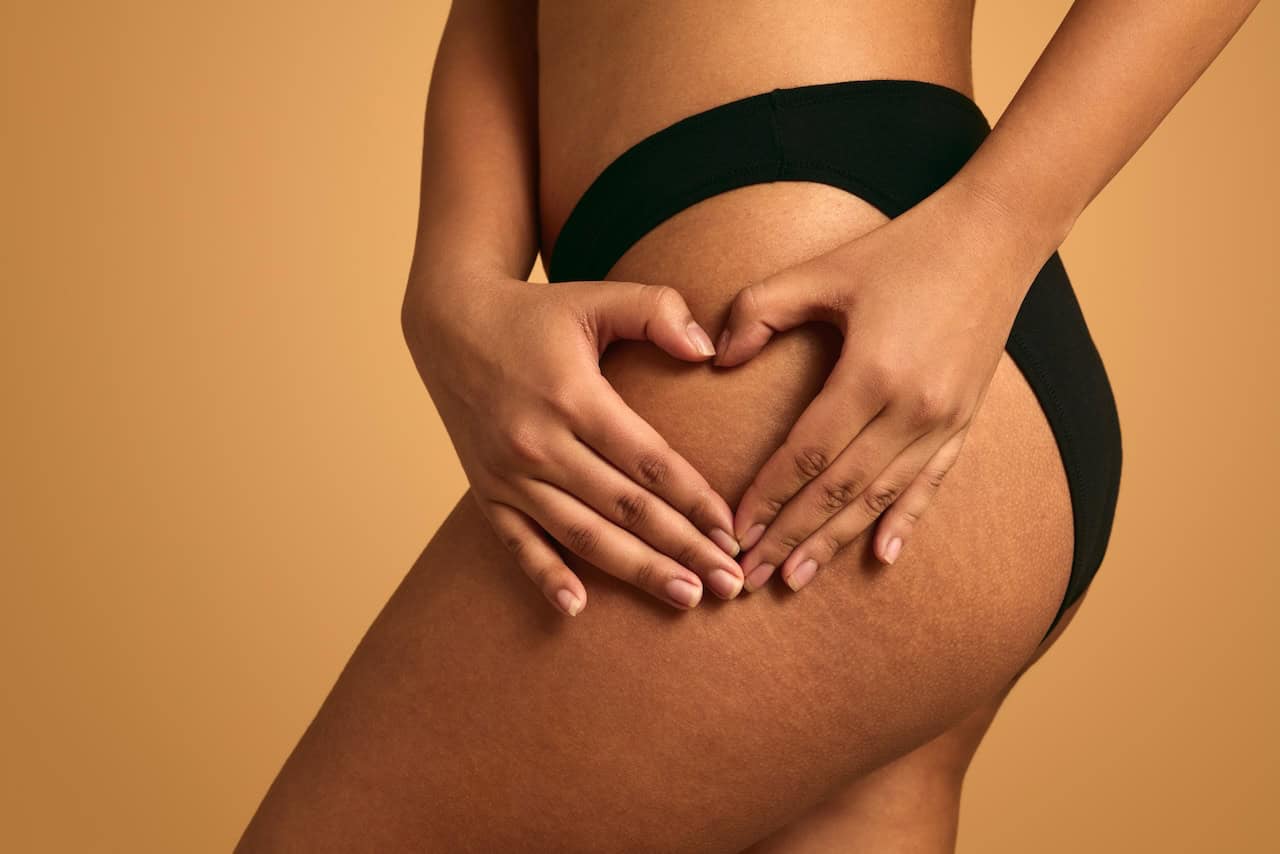 Cellulite and Liposuction