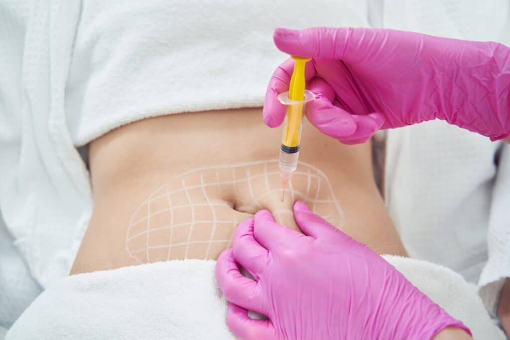 Fat Transfer and Liposuction